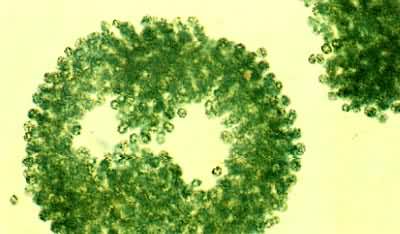 铜绿微囊藻菌